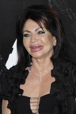 Jackie Stallone, ofoary operacji plastycznych