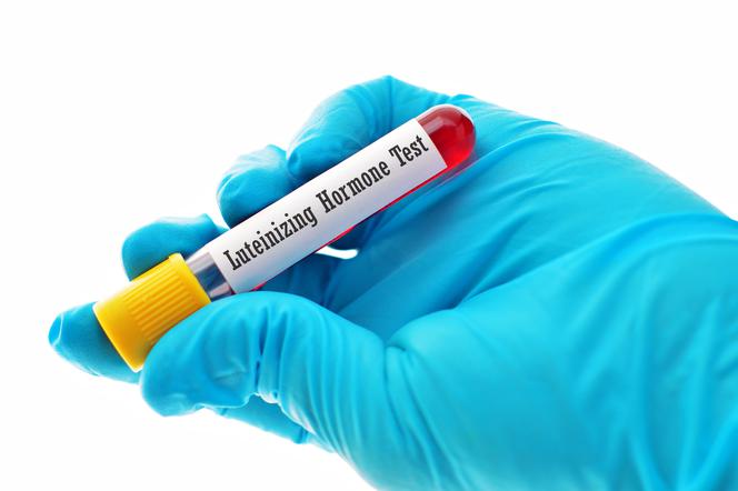 Hormon LH: lutropina, hormon luteinizujący