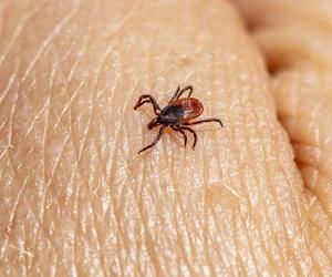 Rośnie liczba zachorowań na choroby odkleszczowe