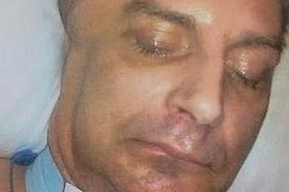 Z zimną krwią rozpłatał Gerardowi głowę młotkiem. Mężczyzna cudem wyrwał się śmierci