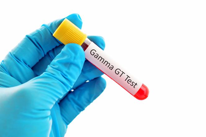 GGTP (gamma-glutamylotranspeptydaza) - rola, stężenie i normy