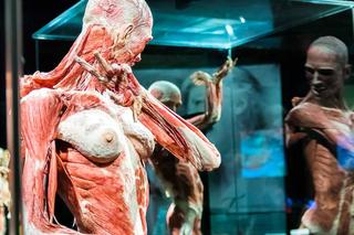 Body Worlds