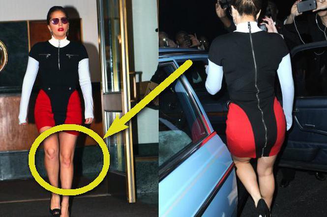 Lady Gaga z obtartymi kolanami