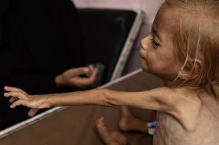 Co 17 minut umiera dziecko. Lekarz z Gazy ujawnia przerażającą prawdę 