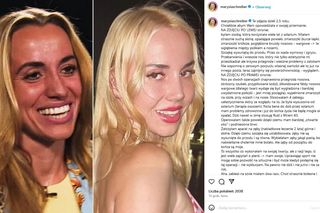 Marianna Schreiber pokazała, co konkretnie poprawiła w twarzy: Przypiłowane kości