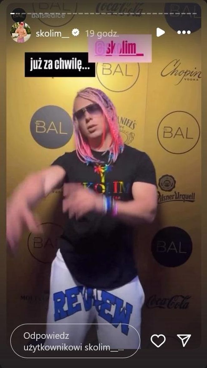 Skolim przeszedł niezłą metamorfozę. Szok, jak teraz wygląda