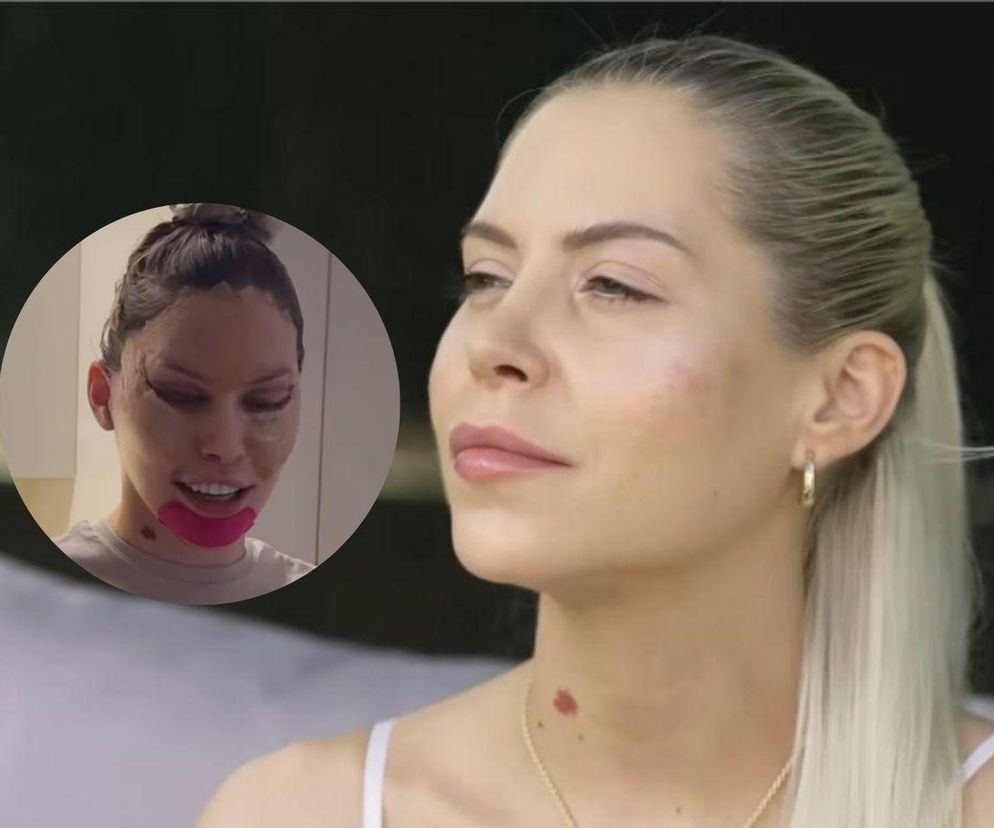 Julia von Stein po operacji