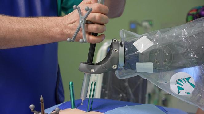 Ponad sto operacji kręgosłupów z udziałem robota w szpitalu wojewódzkim w Szczecinie