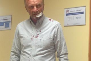 Pobiła go bo czuła się molestowana?