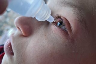 Suche oczy u dziecka to nie zawsze zwykłe zmęczenie. Kiedy iść do lekarza?