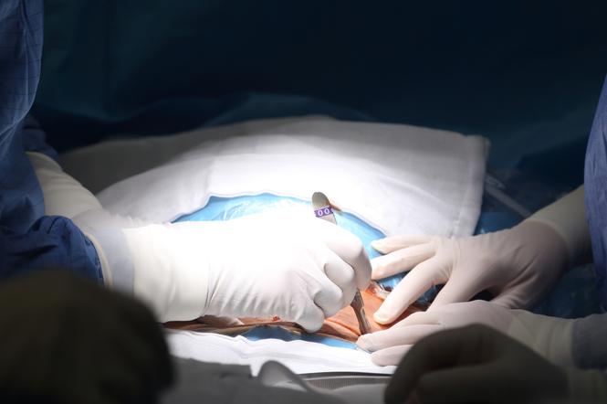 Chirurdzy na sali operacyjnej 