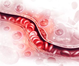 Trombektomia mechaniczna: wskazania, przebieg, powikłania