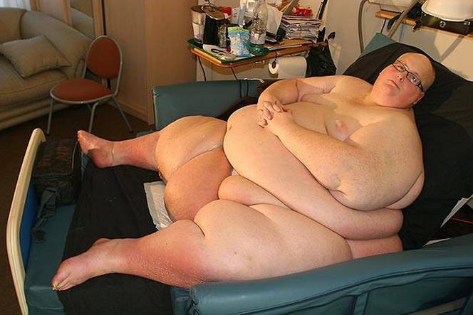 Najgrubszy człowiek świata schudł 300 kilogramów 