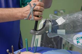 Ponad sto operacji kręgosłupów z udziałem robota w szpitalu wojewódzkim w Szczecinie