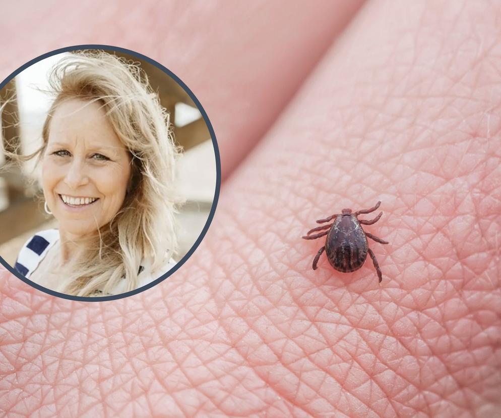 Lekarz odrzucił prawidłową diagnozę. Kobieta już 27 lat walczy z powikłaniami boreliozy