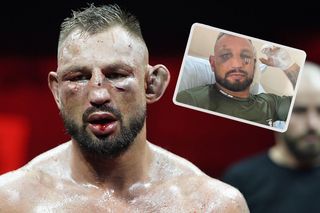 Poważne obrażenia zawodnika Gromdy! Złamania, operacja, tak Damian Kiwior wygląda kilka dni po walce