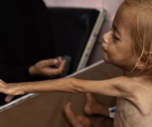 Co 17 minut umiera dziecko. Lekarz z Gazy ujawnia przerażającą prawdę 