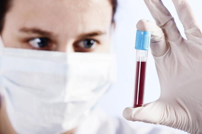 Grupa krwi decyduje o naszym charakterze? Niezwykłe odkrycie japońskich naukowców