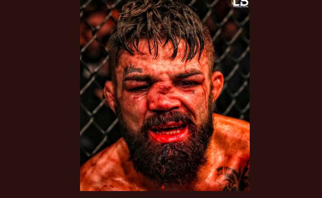 Zawodnik MMA pokazał SZOKUJĄCE zdjęcie. Przestawił mu nos o kilka centymetrów!