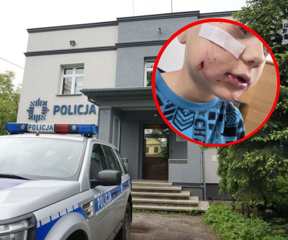 Właścicielowi psa, który pogryzł dziecko grozi nawet więzienie