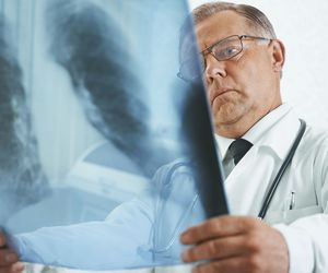 Odma śródpiersia: przyczyny, objawy leczenie