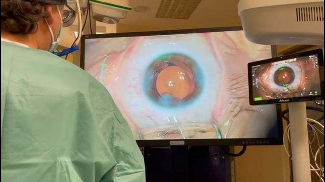Operacja z zastosowaniem najnowszej technologii 3D w SPSK nr 1 w Lublinie