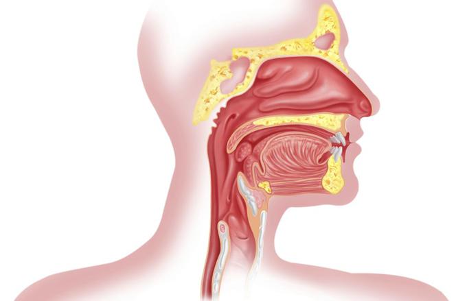 Rak gardła: przyczyny. Jakie są czynniki ryzyka rozwoju raka gardła?