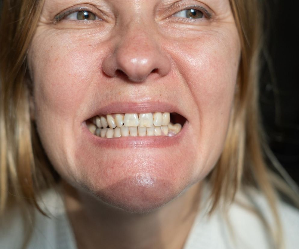 Kobieta z bólem zębów