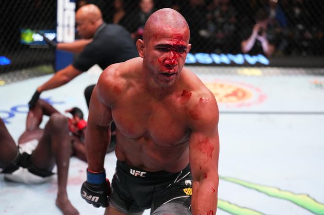 Paskudne rozcięcie na twarzy gwiazdy UFC. Od tego widoku robi się niedobrze