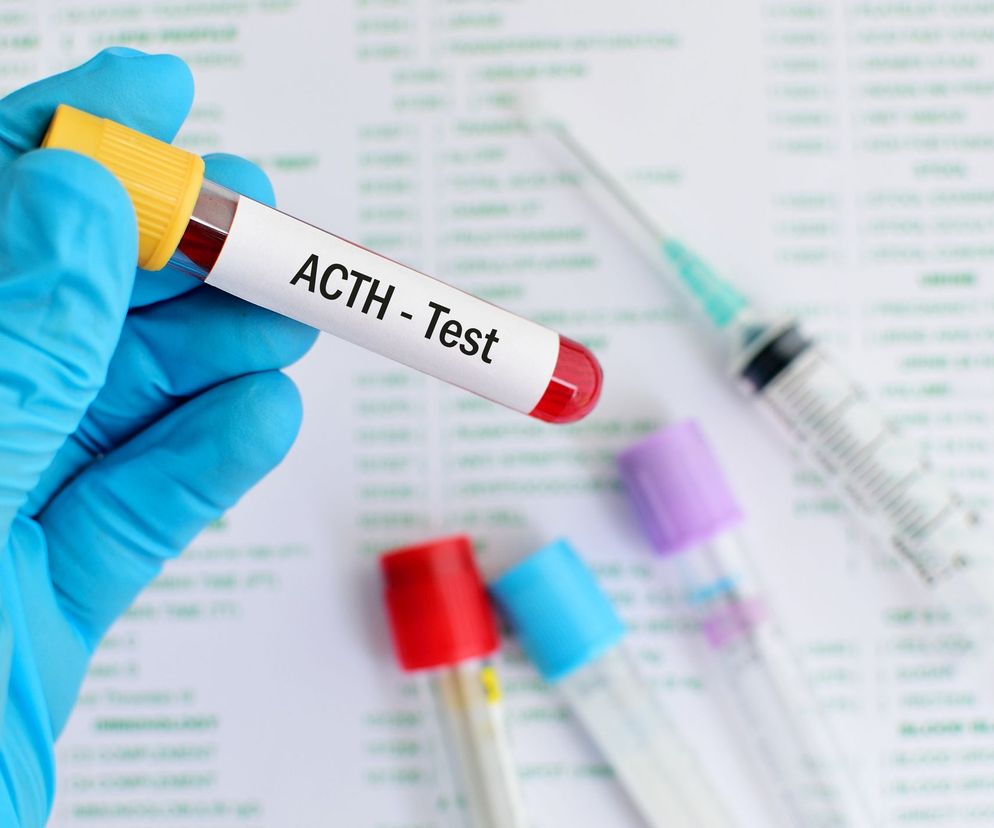 ACTH, inaczej hormon adrenokortykotropowy lub kortykotropina jest hormonem peptydowym produkowanym przez przysadkę.