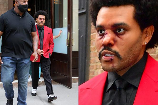 The Weeknd brał udział w bójce?