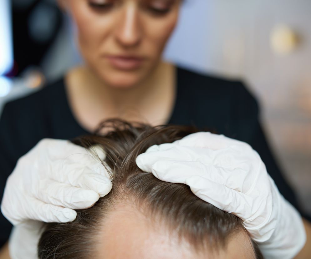 Jak wygląda wizyta u trychologa? Diagnostyka i leczenie skóry głowy oraz włosów