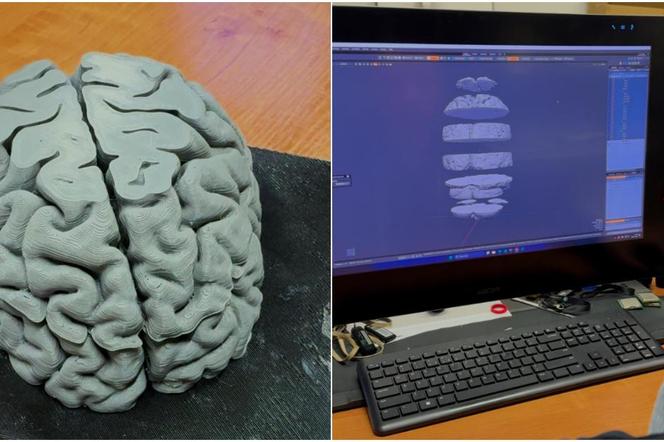 Na KUL-u drukują ludzki mózg. Tak uczą anatomii w 3D!