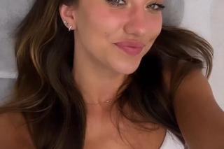 Top Model Klaudia Nieścior robi botoks