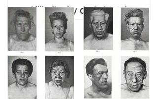 Boję się, że będę miała twarz giganta