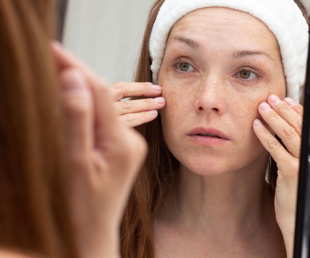 Zmarszczki na czole zwiastunem udaru i zawału. Tak twierdzą badacze.