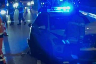 Uwielbiany muzyk uległ wypadkowi. Pokazał zdjęcia! Koncert odwołano