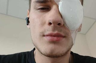 Gwóźdź wbił się w jego oko 20-letniego strażaka OSP. Teraz Kacper ma jedno marzenie [ZDJĘCIA]