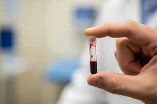 Bezpłatne badania prostaty w Ostrowie. Sprawdź, jak się zapisać i czy spełniasz warunki.