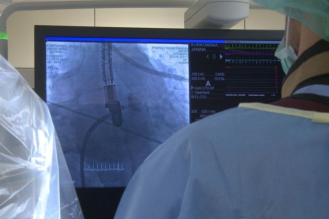 KRIOABLACJA - nowoczesna metoda leczenia MIGOTANIA PRZEDSIONKÓW