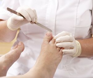 Wrastający paznokieć - klamra zamiast zrywania