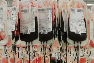 KORONAWIRUS: Epidemia przyczynia się do niskiego stanu grup krwi w RCKiK