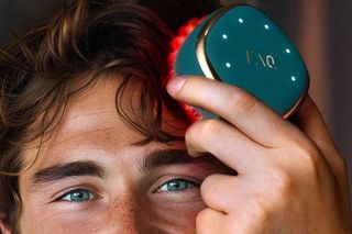 Jak poradzić sobie z wypadaniem włosów? Wypadanie włosów dotyczy co drugiej kobiety i aż trzech na czterech mężczyzn