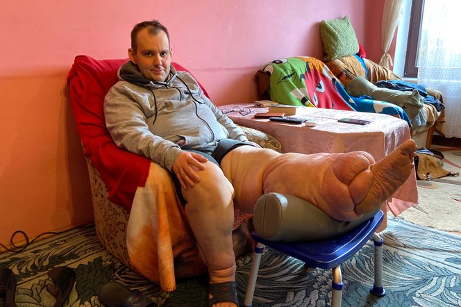 Paweł Kitlas (39 l.) z Białegostoku cierpi na tajemniczą chorobę. Lekarze w Polsce nie potrafią mu pomóc