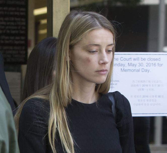 AMBER HEARD POBIŁA SIĘ SAMA?