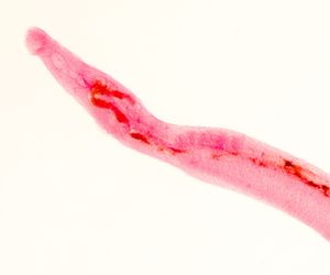 Schistosomatoza: przyczyny, objawy, leczenie