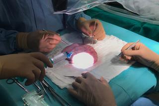 Przyszyli 7-latce skalp. Operacja trwała 7 godzin!