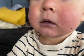 Serduszko Teosia nie ma siły bić