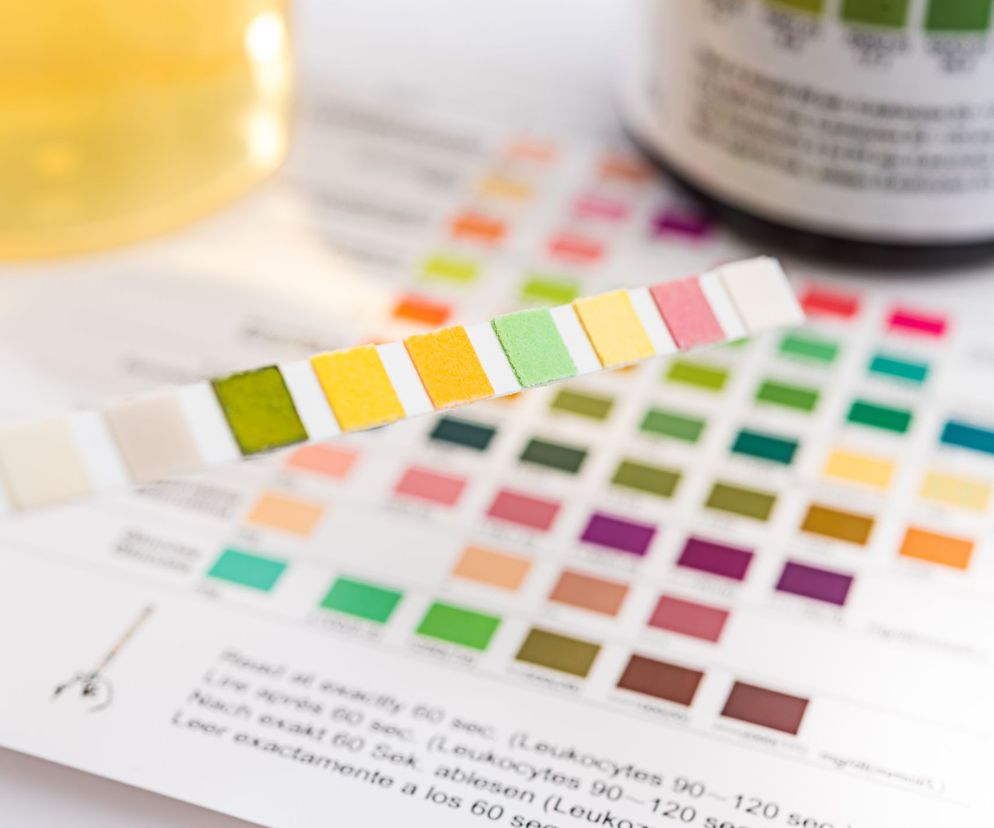 Mętny mocz: czy to powód do niepokoju? Co może oznaczać mętny mocz?