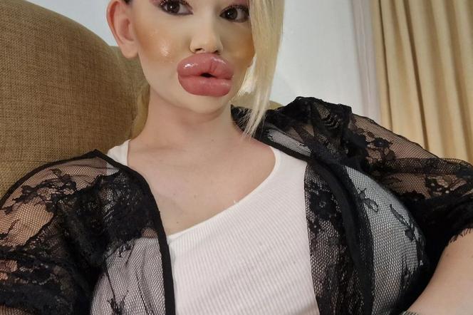 Kobieta z największymi ustami świata marzy też o gigantycznych piersiach. Zrobi wszystko, by wyglądać perfekcyjnie 